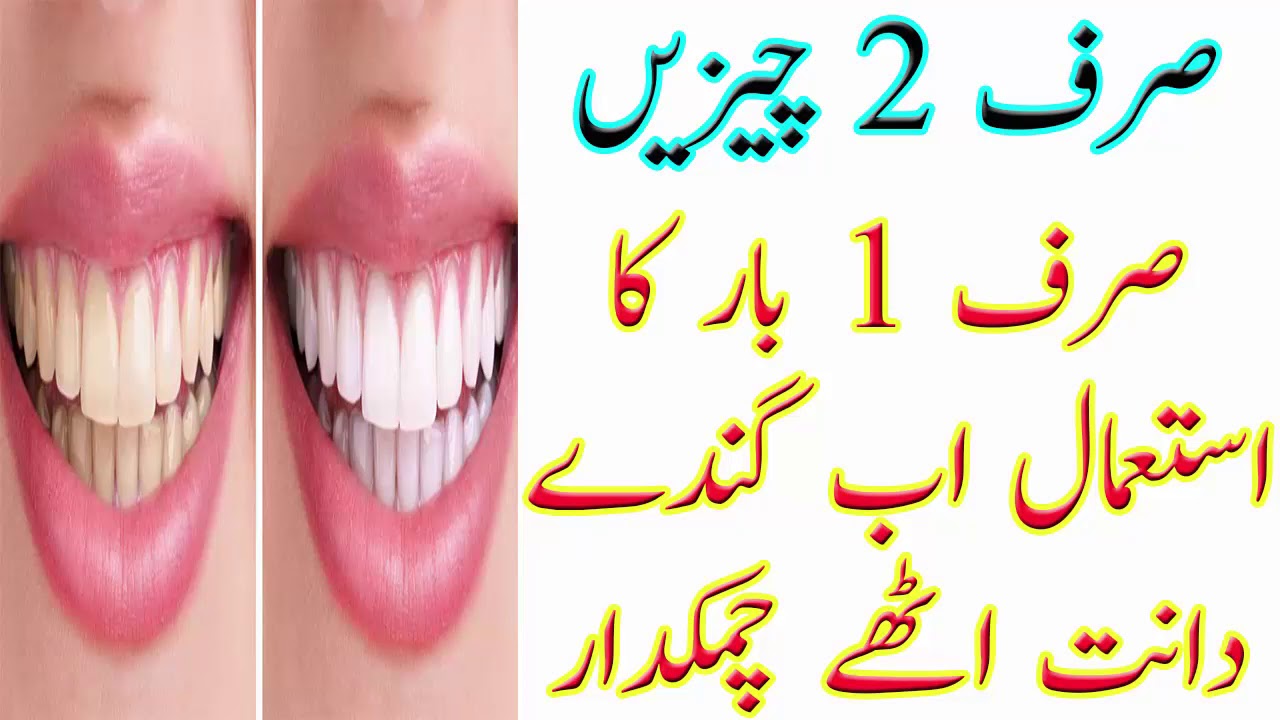 Beauty Tips Sirf 2 Cheezain Sirf 1 Bar Ka Estamal Ab Ganday Dant Uttay beauty-tips-sirf-2-cheezain-sirf-1-bar-ka-estamal-ab-ganday-dant-uttay
