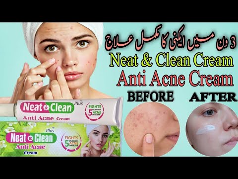 Image showcasing Neat & Clean plus and Neat & clean acne plus cream review (My personal ...