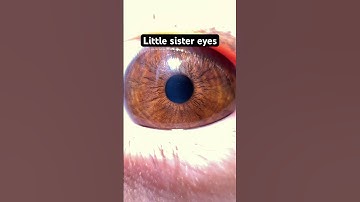 Thumbnail of And my mom has plain brown eyes #asian #wasian #america #eyes #hazel #blue #brown #viral