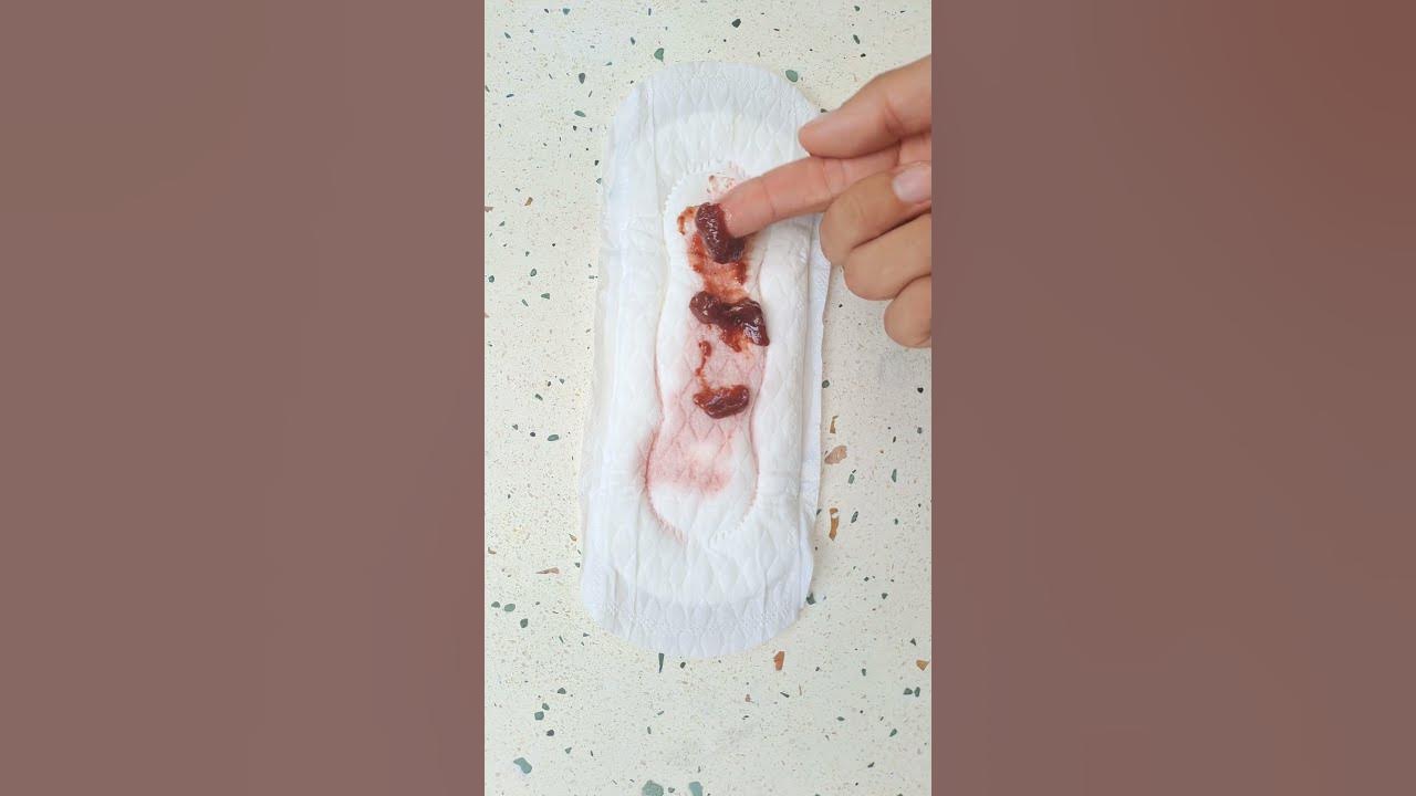 Blutklumpen während der Periode sind normal! YouTube