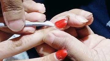 tutorial: how to remove acrylic nails(soak off) fast and 💅🏻 anacrylics @#youtube #nailstylevideo