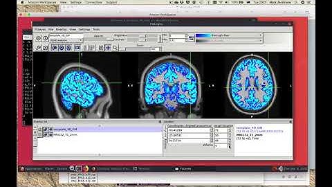Segmentation: Pre-practical Introduction Video