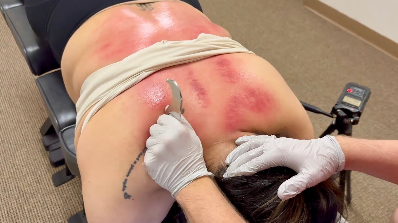 OVERLOOKED HIDDEN PAIN AFTER PREGNANCY