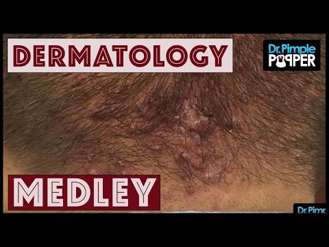 Dr. Pimple Popper Dermatology Medley