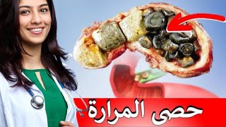 مضاعفات الحصى بالمرارة ( الحجر في المرارة)