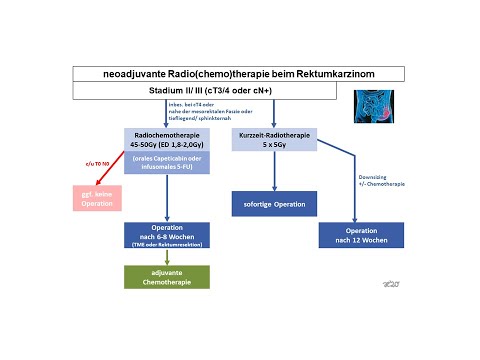 Video: Eine Erhöhte Thrombozytenzahl Ist Ein Negativer Prädiktiver Und Prognostischer Marker Bei Lokal Fortgeschrittenem Rektumkarzinom, Der Sich Einer Neoadjuvanten Radiochemotherapie Un