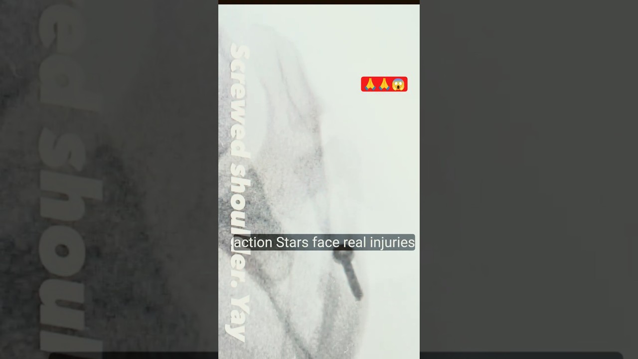 Channing Tatum’s Painful Injury Revealed 😳