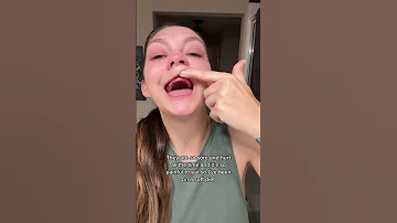 Young Woman Has Dentures