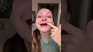 Young Woman Has Dentures screenshot 5