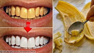 Secret that Dentists don't want you to know: Remove Tartar and Teeth Whitening in just 2 minutes🪥🦷