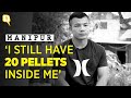 Hit With Over 80 Pellets, This Martial Artist is Now Training to Win Mr Manipur