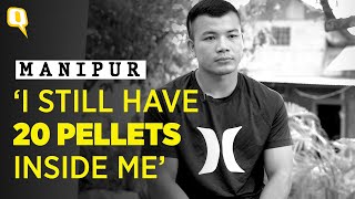Hit With Over 80 Pellets, This Martial Artist is Now Training to Win Mr Manipur