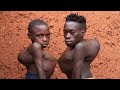 Amazing Brothers With Extreme Body Deformities Shocked The World : BORN DIFFERENT