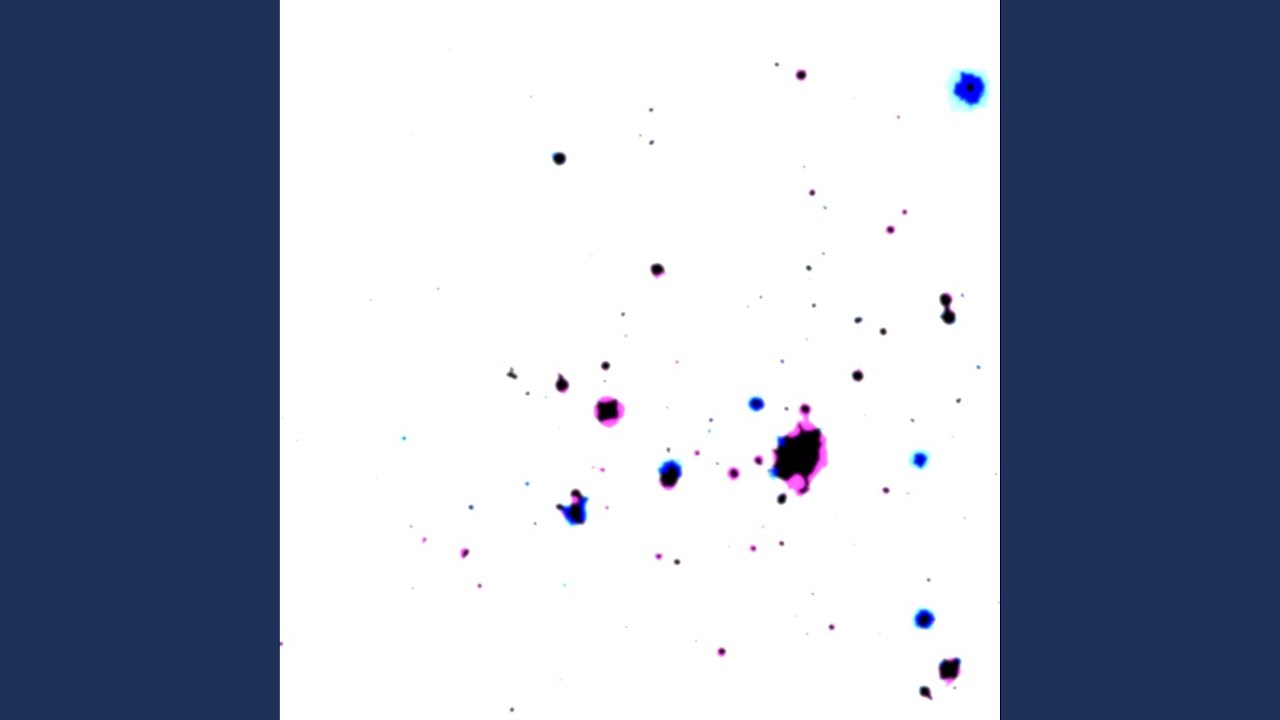 el ruido que escuchas