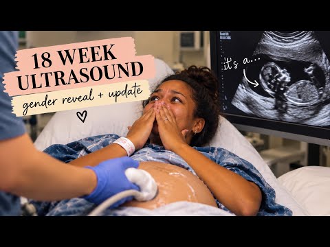 Gender Ultrasound at 18 Weeks · Pregnancy Vlog