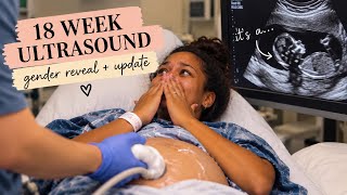 Gender Ultrasound at 18 Weeks · Pregnancy Vlog