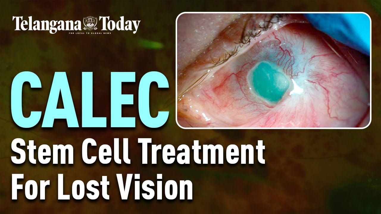 Vision Can Now Be Restored With CALEC | Cultivated Autologous Limbal ...