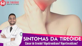 Quais os sintomas da tireóide Hipotireoidismo, Hipertireoidismo, Câncer de tireóide, Bócio