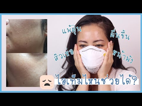 #มณียามาแชร์ สกินแคร์สำหรับผิวแพ้ฝุ่น สิวเห่อ ผื่นขึ้น! | Skincare for Sensitive & Irritated Skin