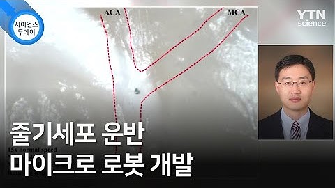 줄기세포 운반 마이크로 로봇 개발 / YTN 사이언스