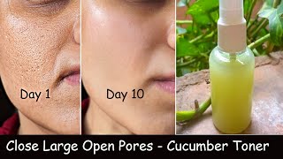 i Sprayed Cucumber Toner on my Face daily & Closed Large Open Pores - Skin Repair & DARK SPOTS screenshot 3