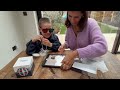 Getting Started with AmblyoPlay | Strabismus Case