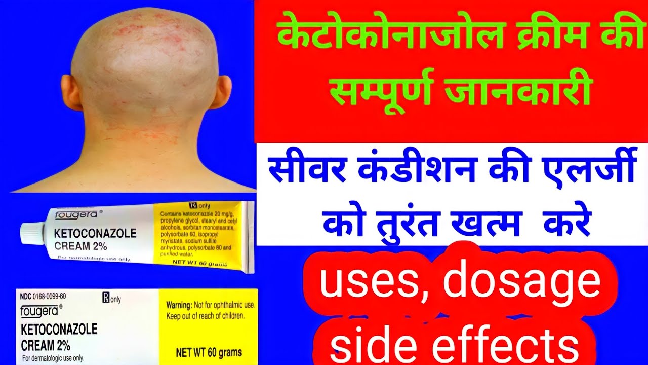 Ketoconazole cream uses in hindi/ketoconazole cream uses/ketoconazole