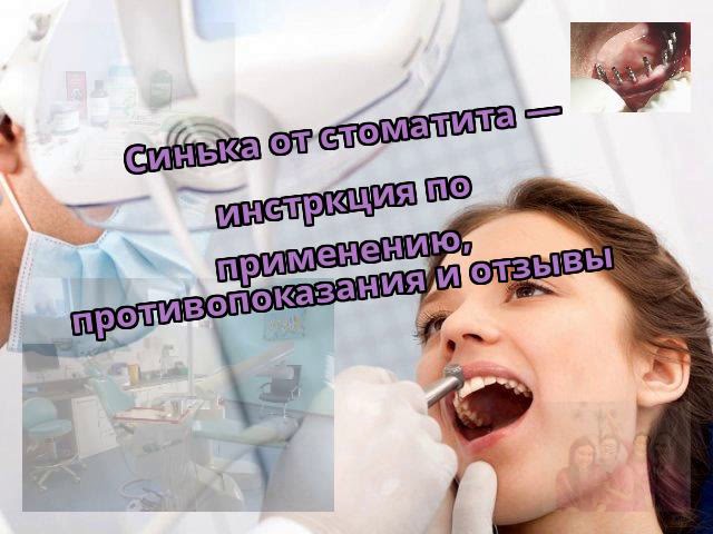 Синька от стоматита — инстркция по применению, противопоказания и отзывы