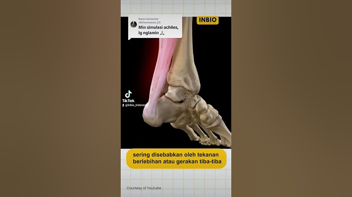 siapa yg pernah ngalamin?