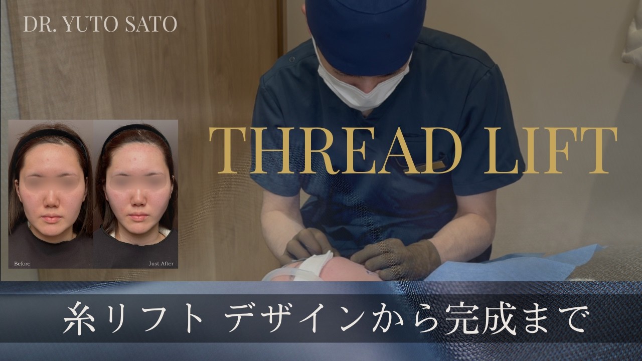 【しっかり持続させる糸リフト】デザインから手術の様子をお見せします。　Dr. Yuto Sato 佐藤由仁