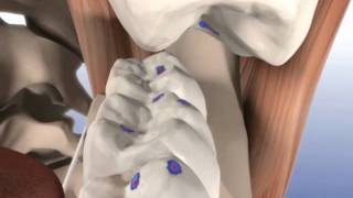 Checking The Occlusion Using The 2 Step Method