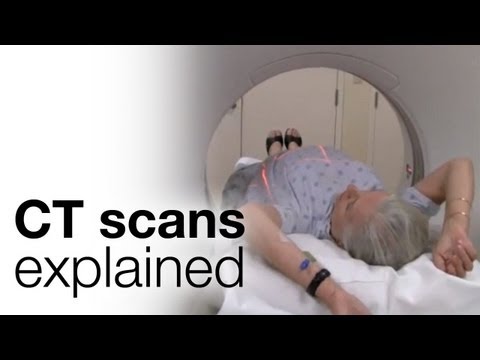 How do you prepare for a CT scan?