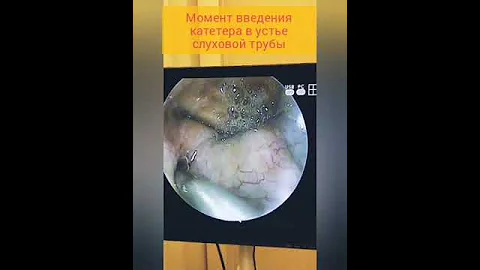Не слышит ухо после гайморита? 🗣️😷  ЛОР врач Александр Горовой