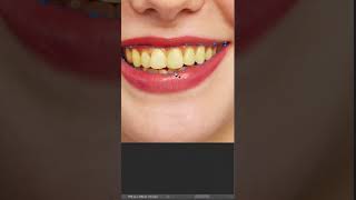 teeth whitening effect in photoshop