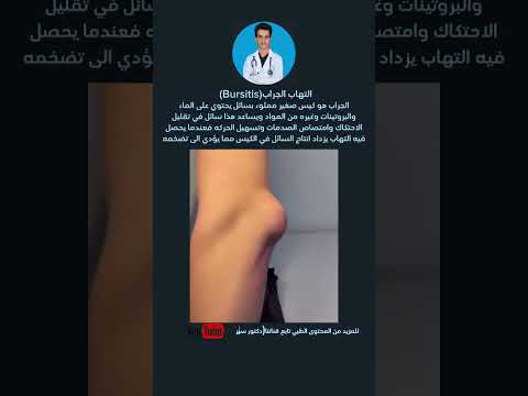 التهاب الجراب  دكتور سيرجن طب