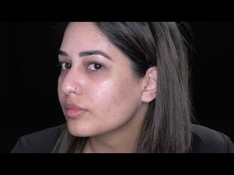 Acne Skin Update -  Weeks OFF Dairy | How to Get Rid of Acne Fast