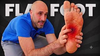 Flat Feet 6 Exercises to Restore Your Arch and Strengthen Your Foot Guide