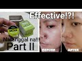 ORGANICA MOLE REMOVER EXPERIENCE PART 2 | (Natanggal na) Effective!!!