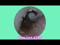 ASMR Ear Cleaning | Guaranteed Tingles and Instant Relaxation