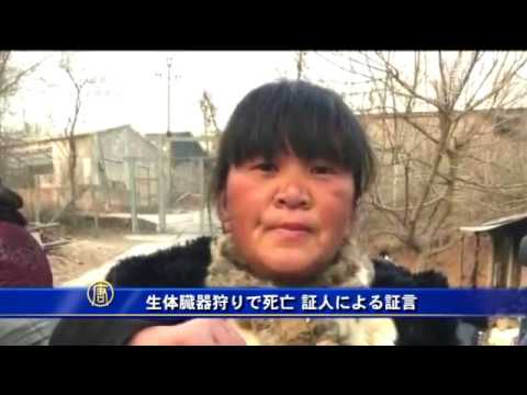 生体臓器狩りで死亡 証人による証言 法輪功学習者 徐真氏さん Youtube 生体臓器狩りで死亡 証人による証言 法輪功学習者 徐真氏さん Youtube