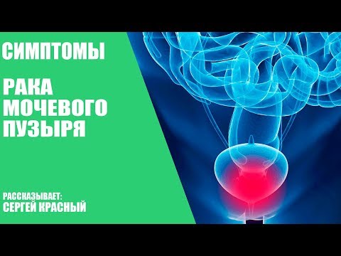 Симптомы рака мочевого пузыря