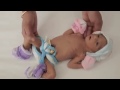 Importance of Kangaroo Mother Care KMC