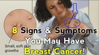 Signs & Symptoms You May Have Breast Cancer! by Medical.Animation.Videos.Library 124,175 views 6 years ago 2 minutes, 45 seconds