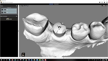 CS 3600 Encode Abutments