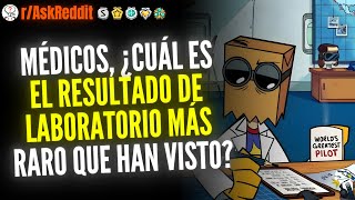 Médicos, Cuál Es El Resultado De Laboratorio Más Raro Que Han Visto? - Reddit