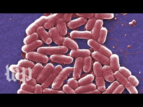 Video: Is e coli sepsis?