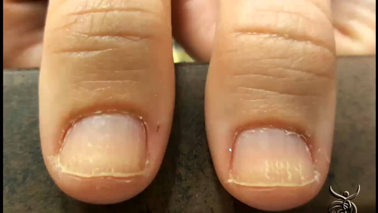 This is the best and least known tip ever to grow your fingernails. Es... |  TikTok
