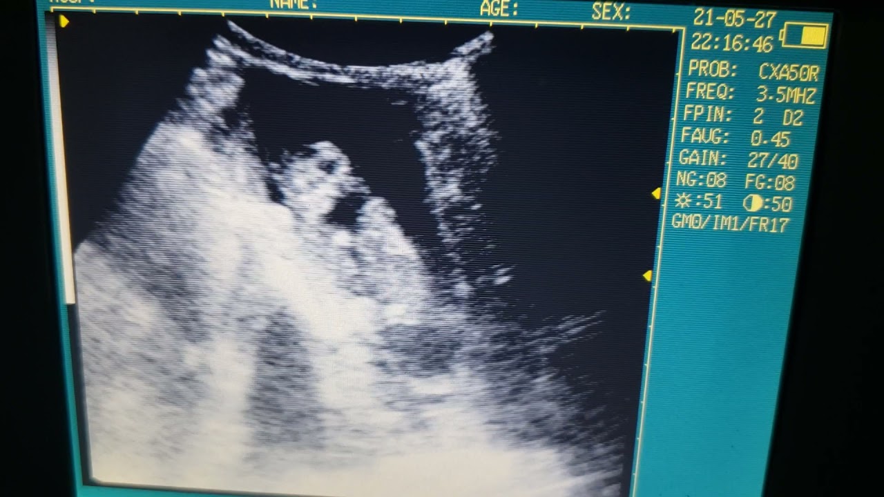 Dachshund ultrasound day 3638 gestation YouTube