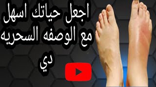 وصفه رائعة لعلاج املاح القدم وتورمات القدم نهائيها.