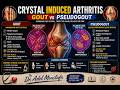 Crystal Induced Arthritis (gout- Pseudogout) -KSIU